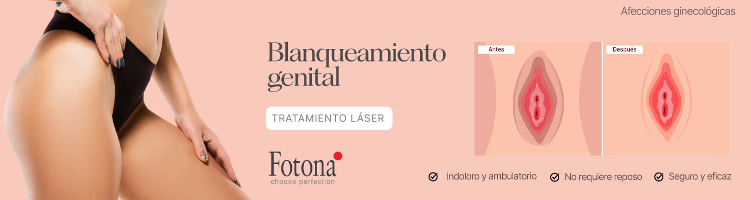 BANNER-BLANQUEAMIENTO