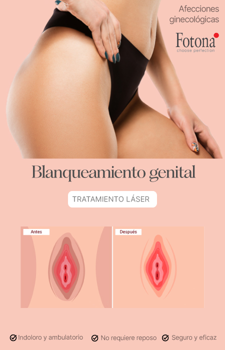 BANNER-BLANQUEAMIENTO-MOBILE