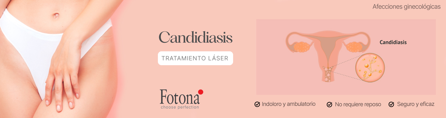 BANNER-CANDIDIASIS