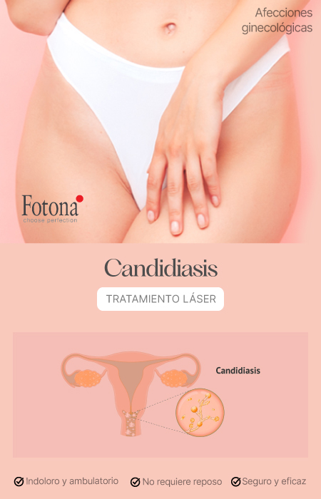 BANNER-CANDIDIASIS-MOBILE