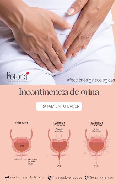 BANNER-INCONTINENCIA-MOBILE