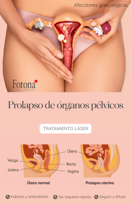 BANNER--PROLAPSO-MOBILE