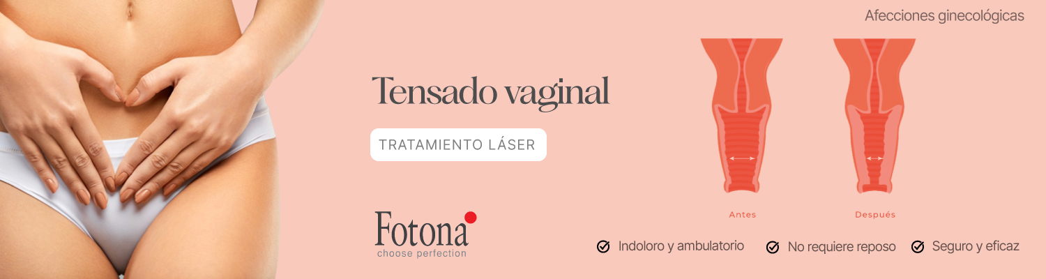 BANNER--TENSADO-VAGINAL