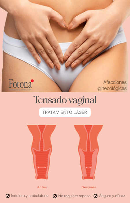BANNER--TENSADO-VAGINAL-MOBILE